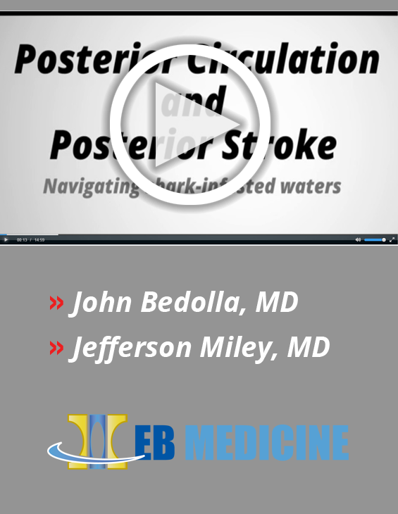 Posterior Circulation And Posterior Stroke: Navigating Shark-Infested Waters